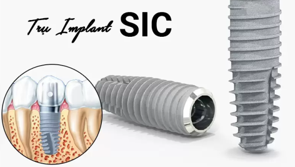 Trụ implant SIC được sản xuất bởi công ty SIC Invent AG có trụ sở tại Basel, Thụy Sĩ.