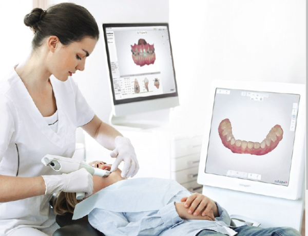 Lấy dấu răng bằng công nghệ Scan 3D là phương pháp hiện đại nhất hiện nay