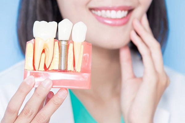 Răng implant có độ thẩm mỹ và tính tự nhiên gần như hoàn hảo so với răng thật
