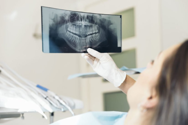 Nên chụp X-quang để kiểm tra tình trạng sức khỏe răng miệng