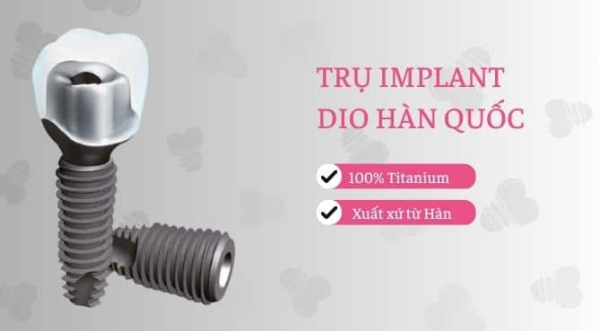 Trụ Implant DIO Hàn Quốc có tốt không? Giá cả bao nhiêu?
