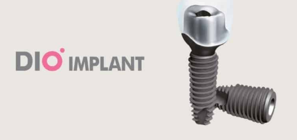 Trụ implant DIO được sản xuất bởi công ty Digoa Dental của Hàn Quốc