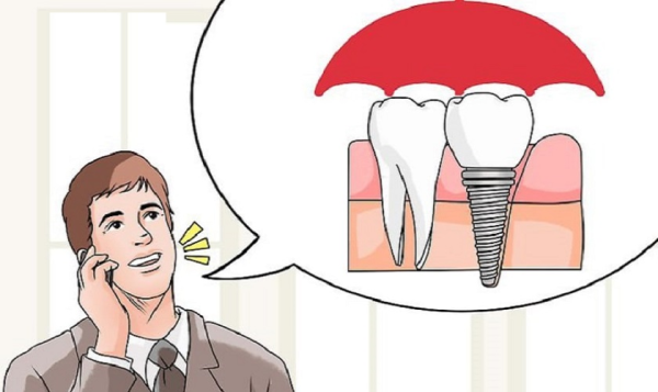Có nên trồng răng implant không?