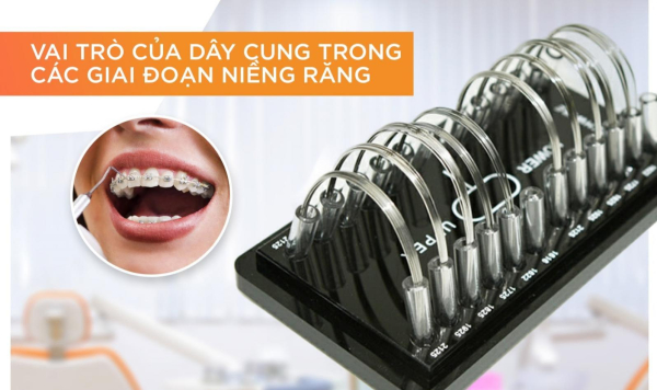 Các loại dây cung thường dùng trong niềng răng cài sứ