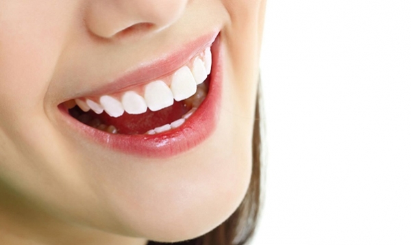 Răng sâu nên bọc sứ hay trám răng?