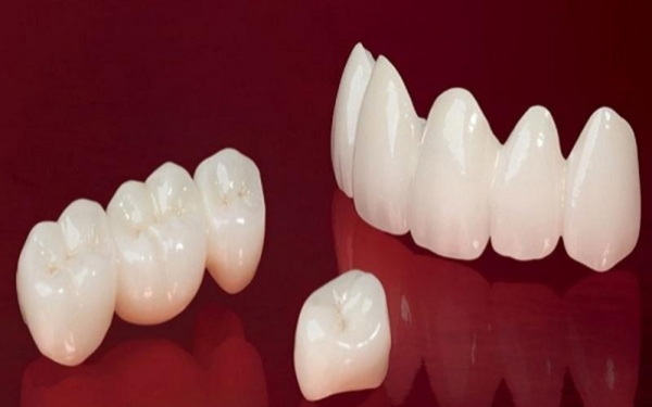 Răng sứ ceramill zolid: lựa chọn hoàn hảo cho nụ cười đẹp