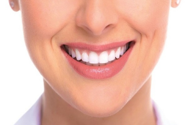Dáng răng sứ tự nhiên - form răng sứ đẹp phổ biến nhất