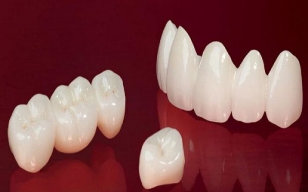 Răng sứ Ceramill có mấy loại? Nên chọn loại nào tốt nhất?